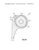 ELBOW PROSTHESIS diagram and image