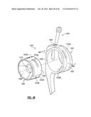 ELBOW PROSTHESIS diagram and image