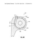 ELBOW PROSTHESIS diagram and image