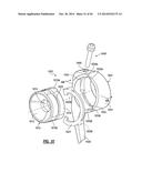 ELBOW PROSTHESIS diagram and image