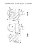 ELBOW PROSTHESIS diagram and image