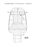 ELBOW PROSTHESIS diagram and image