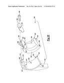 ELBOW PROSTHESIS diagram and image