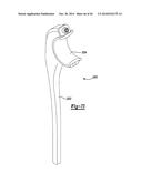 ELBOW PROSTHESIS diagram and image