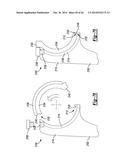 ELBOW PROSTHESIS diagram and image