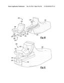 ELBOW PROSTHESIS diagram and image