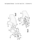 ELBOW PROSTHESIS diagram and image