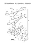 ELBOW PROSTHESIS diagram and image