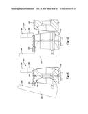 ELBOW PROSTHESIS diagram and image