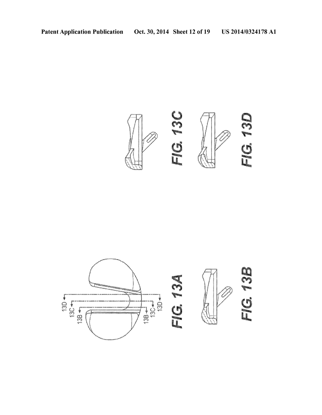 CRUCIATE-RETAINING TIBIAL PROSTHESIS - diagram, schematic, and image 13