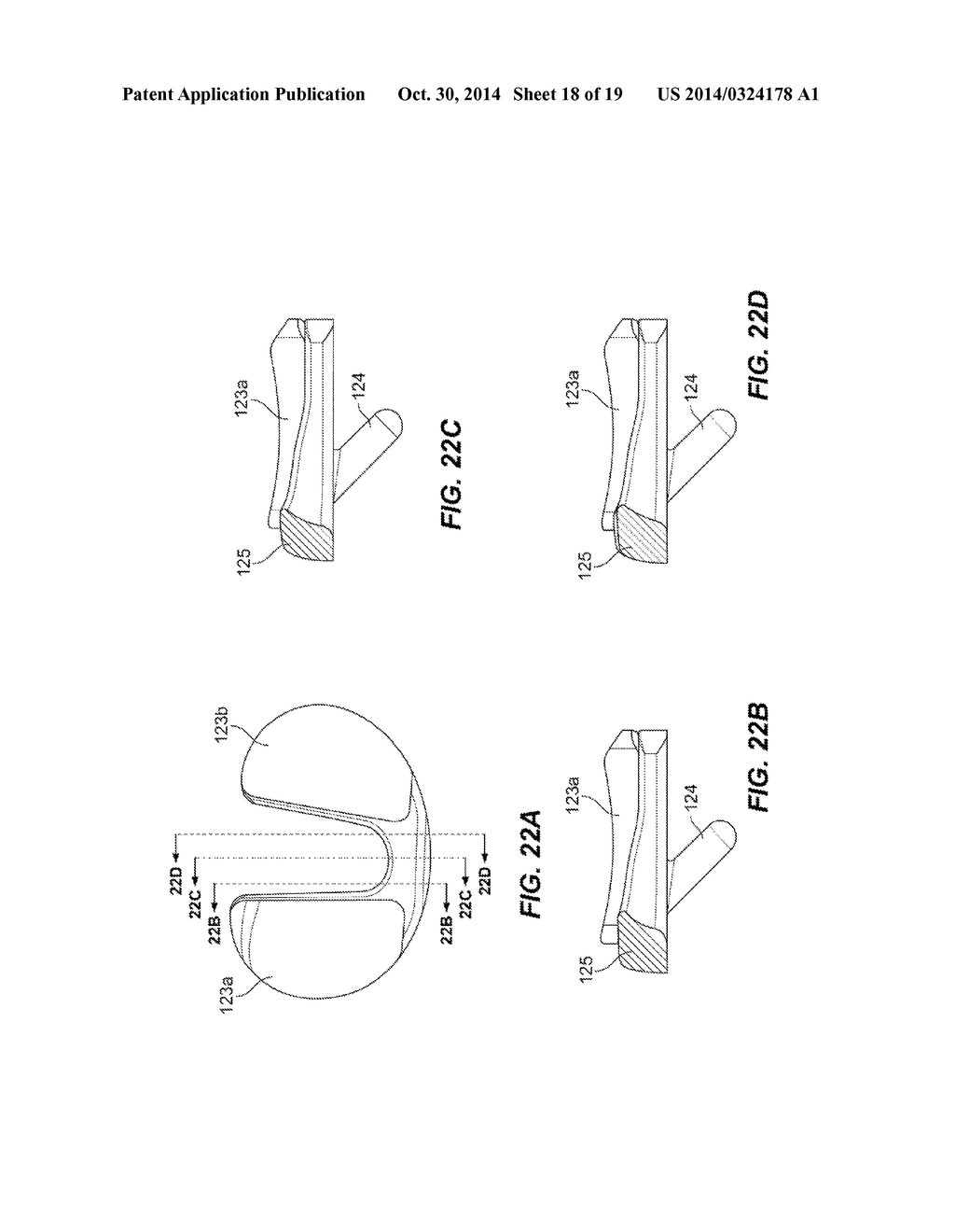 CRUCIATE-RETAINING TIBIAL PROSTHESIS - diagram, schematic, and image 19