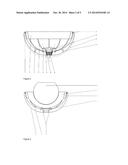 PROSTHETIC ACETABULAR CUP diagram and image