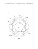 Female Snap Button and Snap Button diagram and image