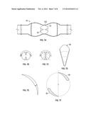 Fuel Turbine and Throttle Box diagram and image