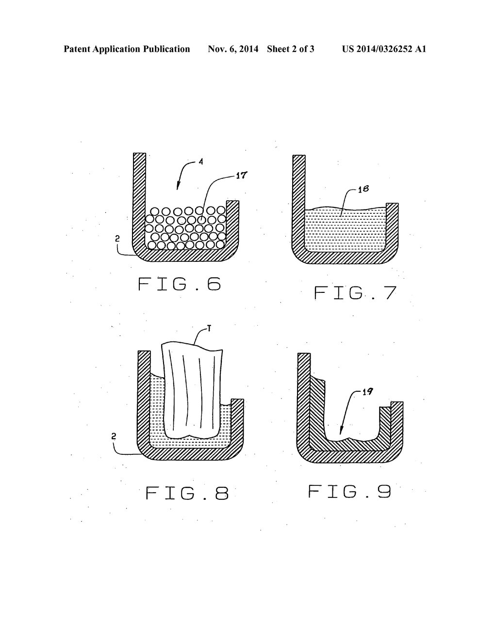 Anti-snoring and sleep apnea device - diagram, schematic, and image 03