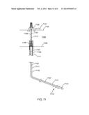 Methods of Hydraulically Fracturing and Recovering Hydrocarbons diagram and image