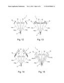 LIGHTING DEVICE FOR FORMING AN ILLUMINATION SPOT OF VARIABLE DIAMATER AND     OF VARIABLE COLOR TEMPERATURE diagram and image