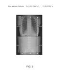 SYSTEMS AND METHODS FOR COMPUTED TOMOGRAPHY (CT) IMAGING USING VARIABLE     IMAGE QUALITY FACTORS OR IMAGE CAPTURE SETTINGS IN A SINGLE ACQUISITION diagram and image