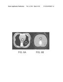 SYSTEMS AND METHODS FOR COMPUTED TOMOGRAPHY (CT) IMAGING USING VARIABLE     IMAGE QUALITY FACTORS OR IMAGE CAPTURE SETTINGS IN A SINGLE ACQUISITION diagram and image