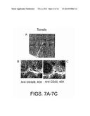 Combination of FcgammaRIIB-Specific Antibodies and CD20-Specific     Antibodies and Methods of Use Thereof diagram and image