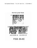 Combination of FcgammaRIIB-Specific Antibodies and CD20-Specific     Antibodies and Methods of Use Thereof diagram and image