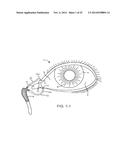 DRUG DELIVERY METHODS, STRUCTURES, AND COMPOSITIONS FOR NASOLACRIMAL     SYSTEM diagram and image