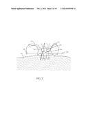 System And Method For A Bone Engaging Dental Implant Surgical Stent     Placement System diagram and image