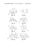 System And Method For A Bone Engaging Dental Implant Surgical Stent     Placement System diagram and image