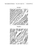 NOVEL METHODS OF USE OF HSP70 FOR INCREASED PERFORMANCE OR TREATMENT OF     HSP70 RELATED DISORDERS diagram and image