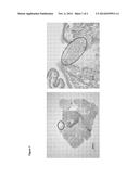 Amphiphilic Peptides for Thoracic Air Leakage Occlusion diagram and image