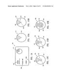 GRAPHICAL USER INTERFACE FOR TISSUE BIOPSY SYSTEM diagram and image