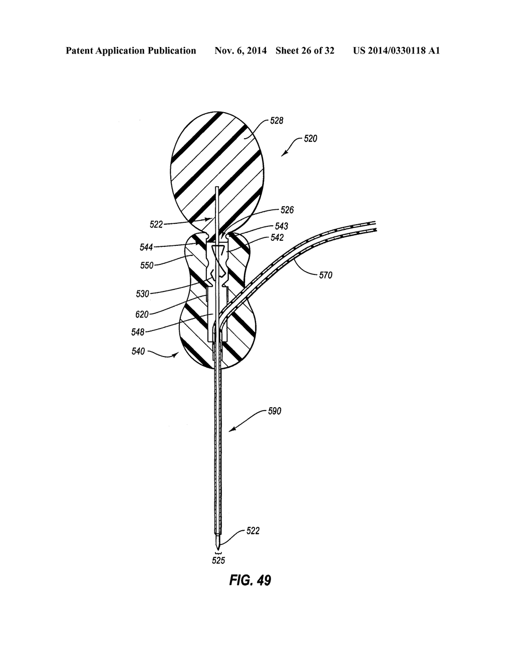 Assemblies for Identifying a Power Injectable Access Port - diagram, schematic, and image 27