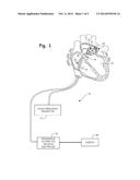 PERSISTENT DISPLAY OF NEAREST BEAT CHARACTERISTICS DURING REAL-TIME OR     PLAY-BACK ELECTROPHYSIOLOGY DATA VISUALIZATION diagram and image