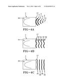 METHOD OF ACOUSTIC SHOCK WAVE TREATMENTS FOR COMPLICATIONS ASSOCIATED WITH     SURGICAL MESH IMPLANTS diagram and image