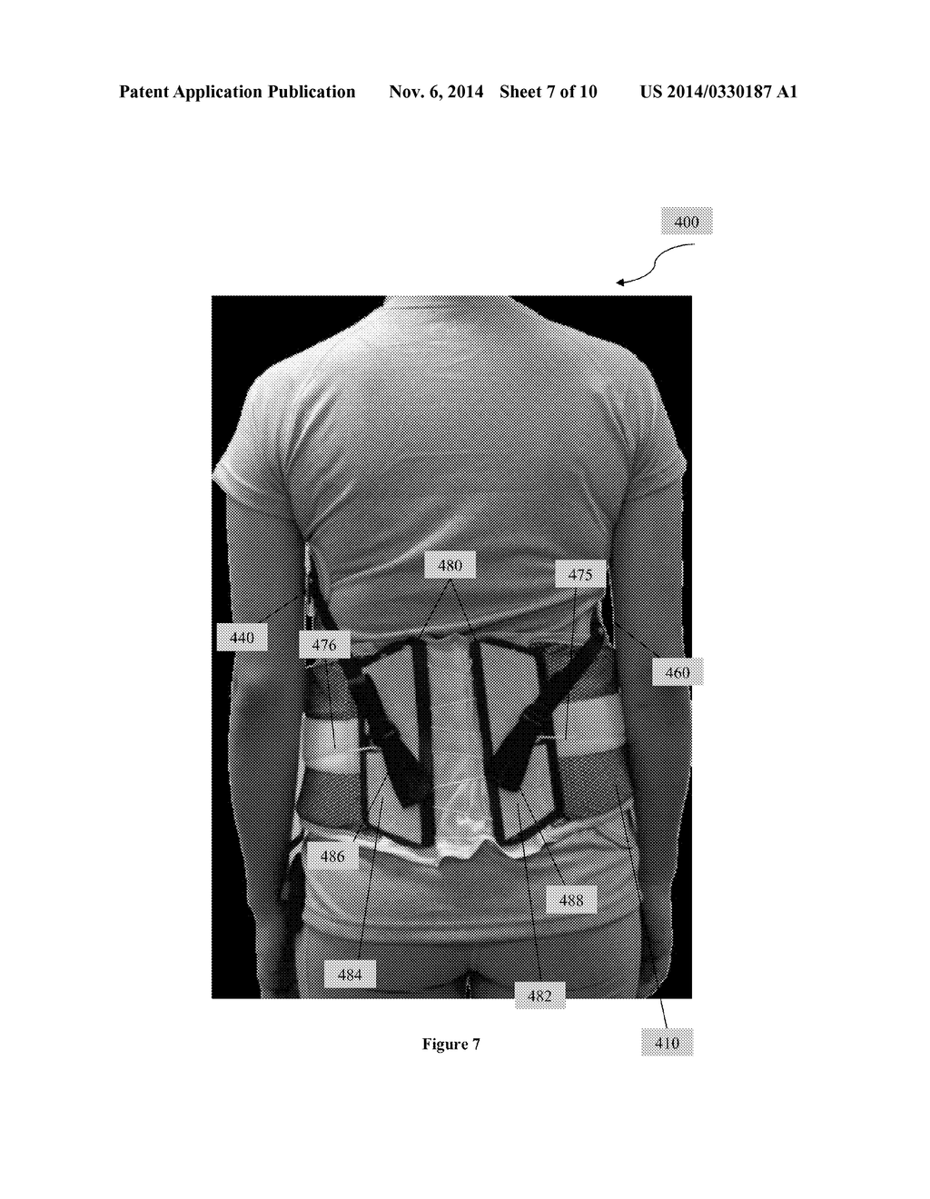 Scoliosis Brace - diagram, schematic, and image 08