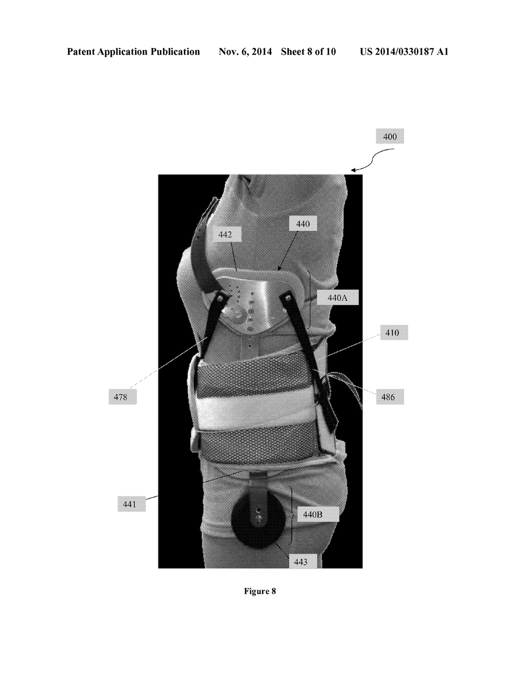 Scoliosis Brace - diagram, schematic, and image 09