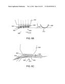 APPARATUS FOR STIMULATING HAIR GROWTH AND/OR PREVENTING HAIR LOSS diagram and image