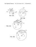 APPARATUS FOR STIMULATING HAIR GROWTH AND/OR PREVENTING HAIR LOSS diagram and image