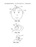 APPARATUS FOR STIMULATING HAIR GROWTH AND/OR PREVENTING HAIR LOSS diagram and image