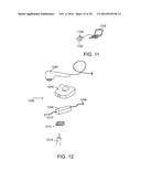 APPARATUS FOR STIMULATING HAIR GROWTH AND/OR PREVENTING HAIR LOSS diagram and image