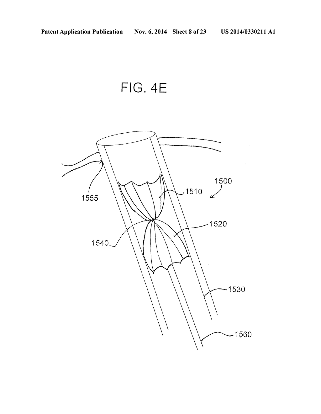 ENGAGEMENT AND DELIVERY CATHETER SYSTEMS - diagram, schematic, and image 09