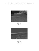 ABSORBENT ARTICLES COMPRISING STRETCH LAMINATES diagram and image