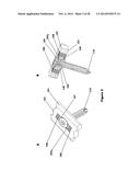 FLEXIBLE PLATE FIXATION OF BONE FRACTURES diagram and image