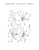 FLEXIBLE PLATE FIXATION OF BONE FRACTURES diagram and image