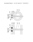 FLEXIBLE PLATE FIXATION OF BONE FRACTURES diagram and image