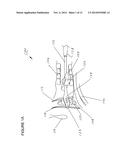 METHODS AND APPARATUSES FOR TREATING TONSILS diagram and image