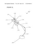 METHODS AND APPARATUSES FOR TREATING TONSILS diagram and image