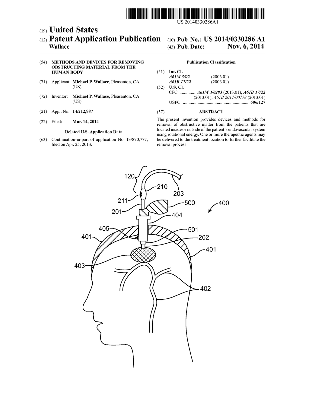 Methods and Devices for Removing Obstructing Material From the Human Body - diagram, schematic, and image 01
