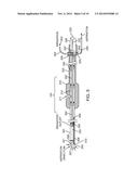 Methods and Devices for Removing Obstructing Material From the Human Body diagram and image