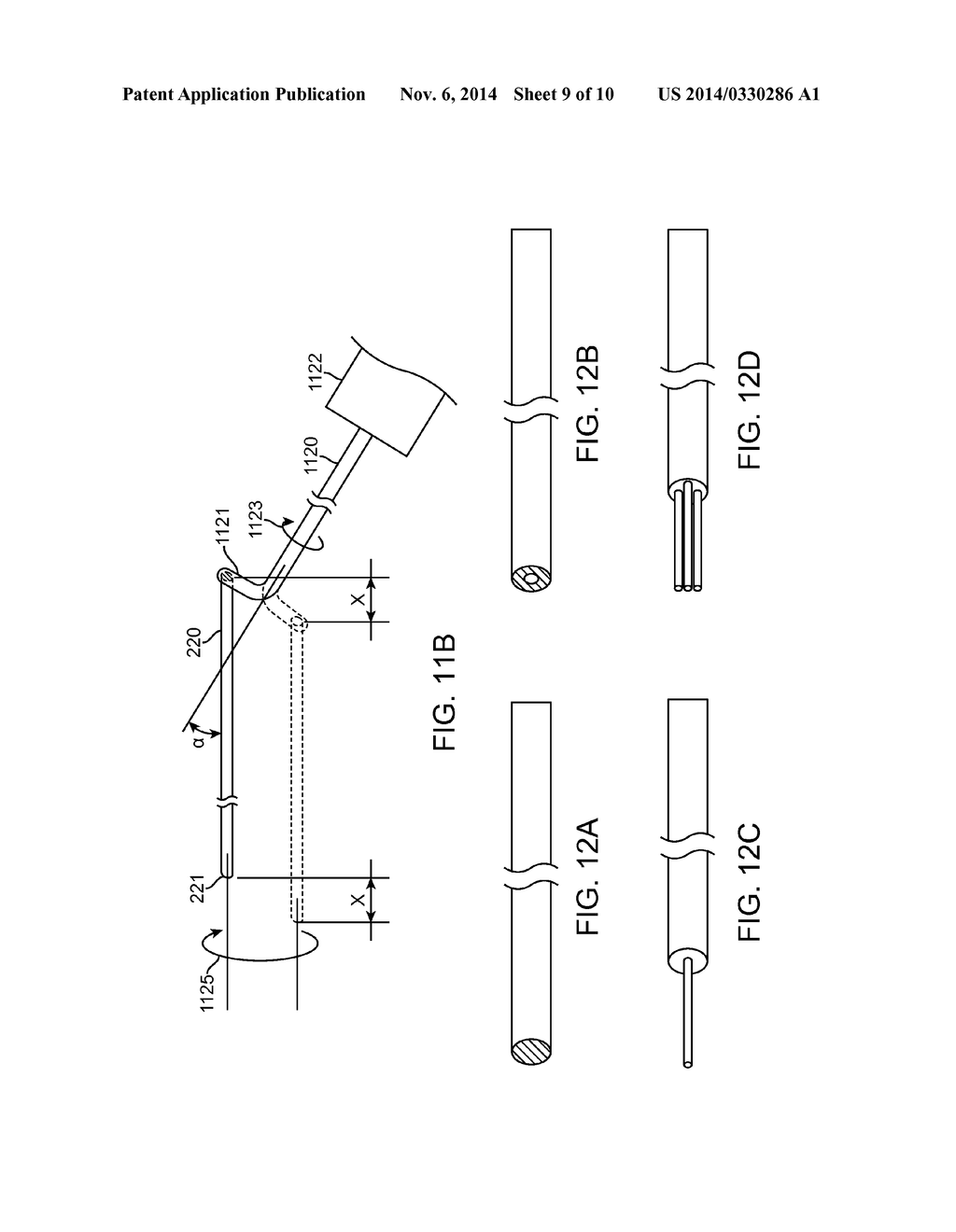 Methods and Devices for Removing Obstructing Material From the Human Body - diagram, schematic, and image 10